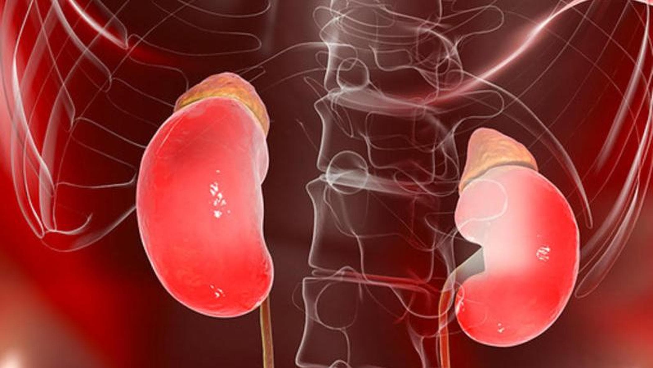 Tumori benigni del surrene come la secrezione di cortisolo aumenta i rischi cardiovascolari